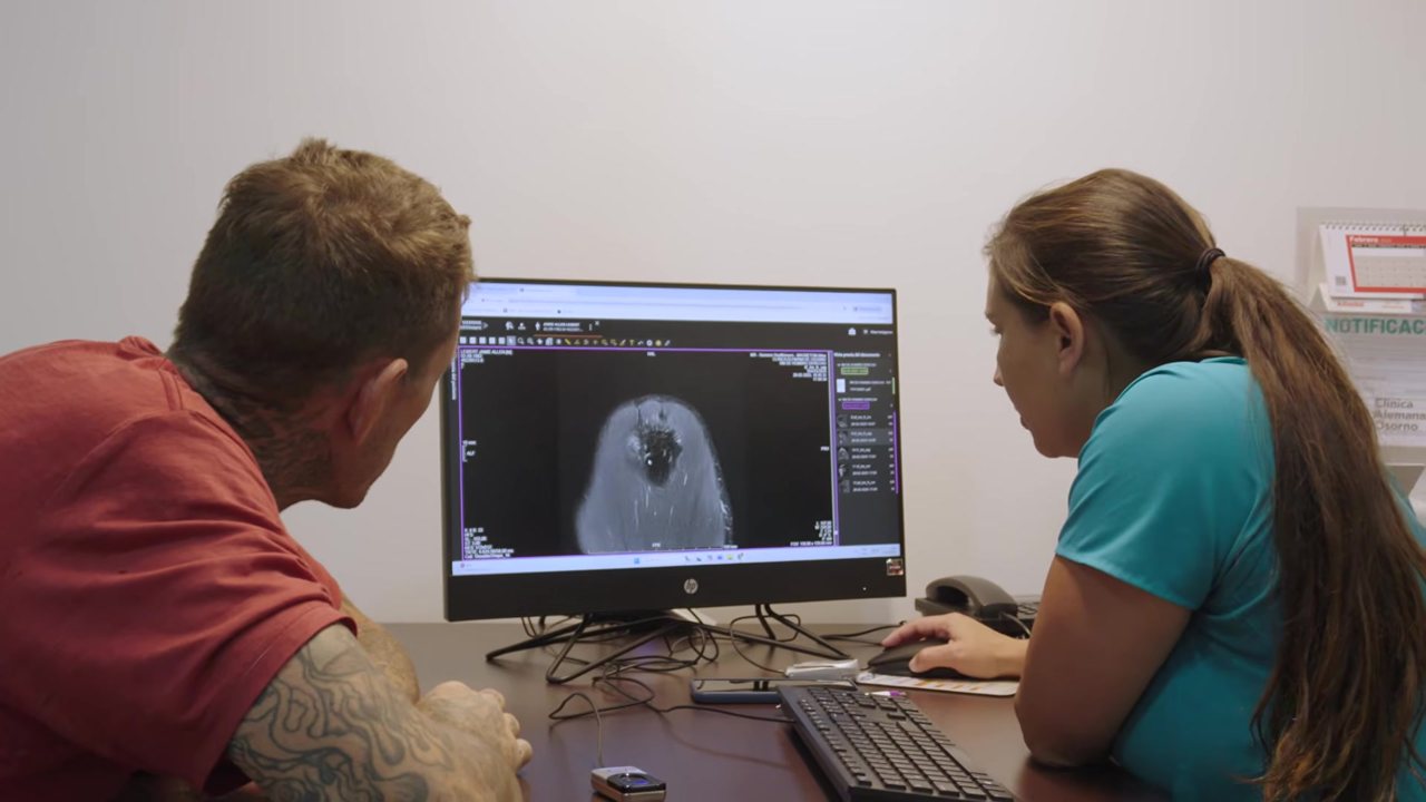 Reviewing the shoulder X-ray